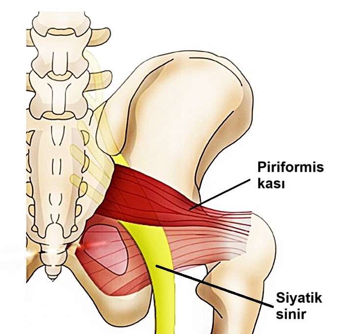 Piriformis Sendromu